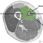 Cross-section of the thigh showing the borders of the adductor canal providing context for leg anatomy during travel
