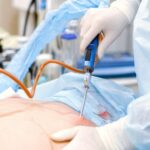 Woman Relaxing After Liposuction