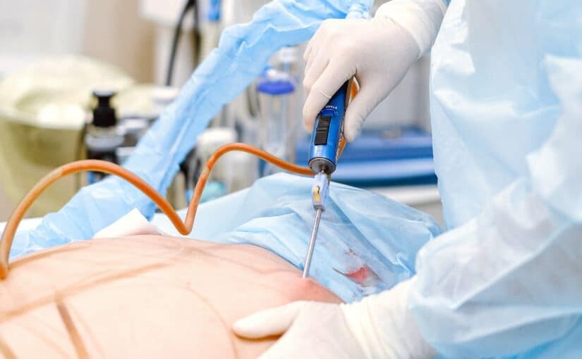 Woman Relaxing After Liposuction