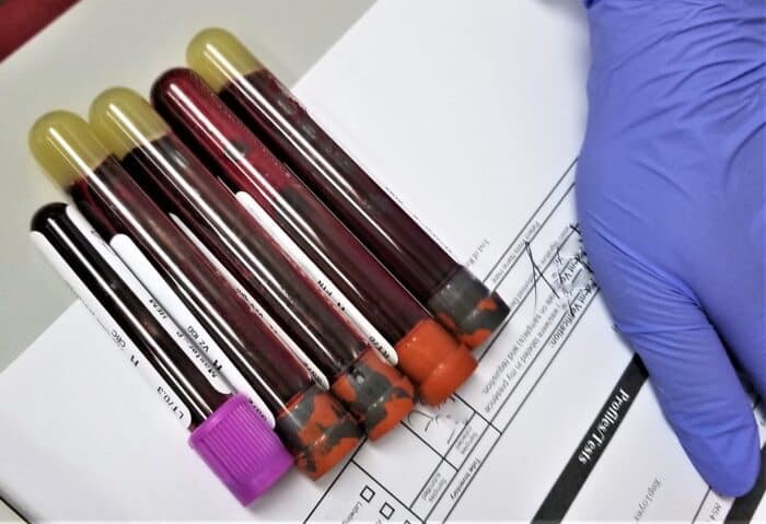 Phlebotomist performing a procedure