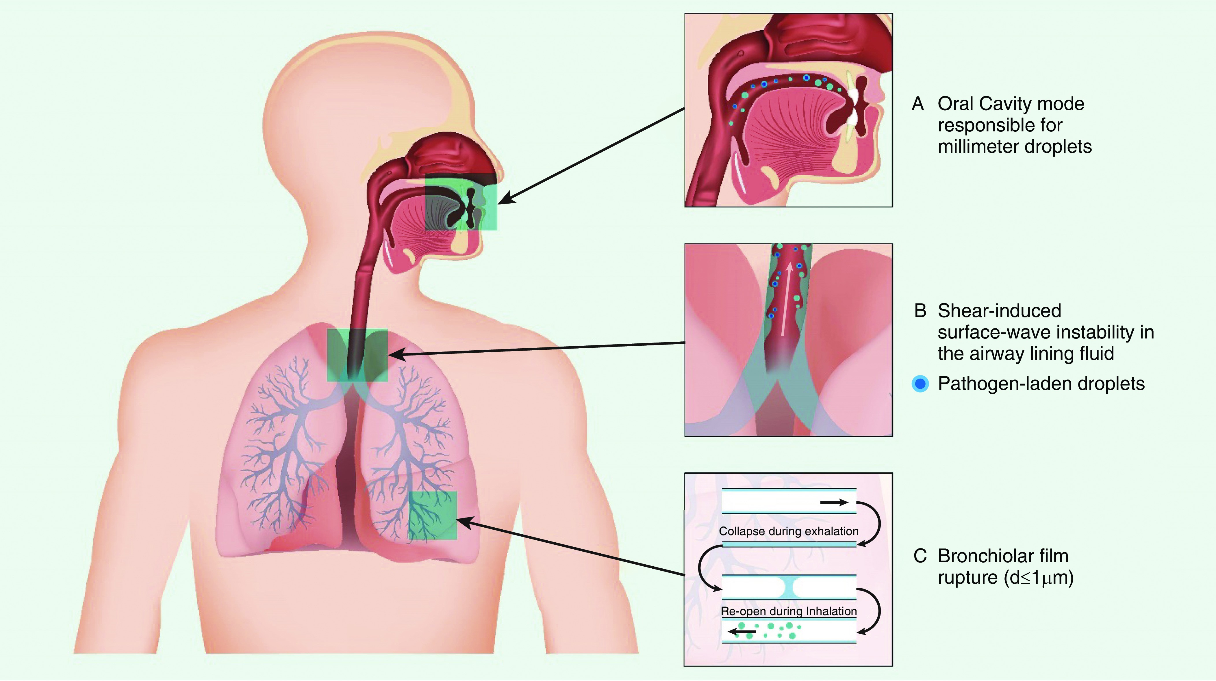 Coughing mechanisms